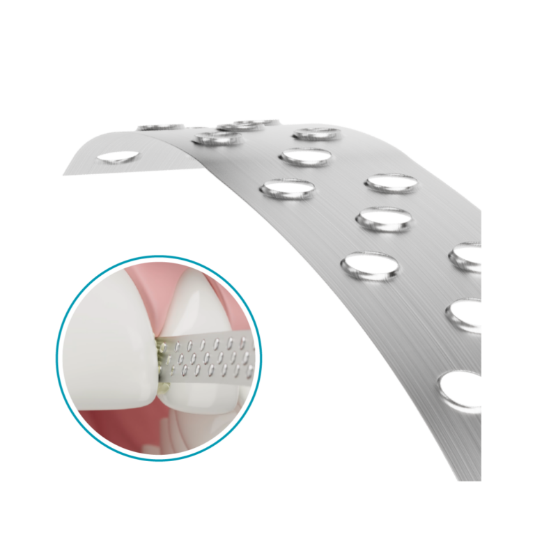 Stainless Steel Prophylaxis Strips Micro Blades 10.319.007 Denfinity