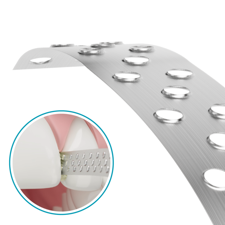 Stainless Steel Prophylaxis Strips Micro-Blades 4.0mm 10.319.007 Denfinity